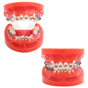 Зъбни смоли, Ортодонтическая модел на зъбите, стоматологичен артикулятор, обучение модел, продукти за зъболекари